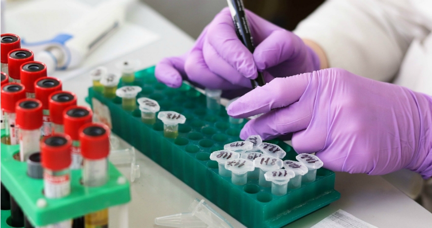 CHMP aprova redu&ccedil;&atilde;o de glecaprevir/pibrentasvir em doentes com hepatite C com cirrose compensada