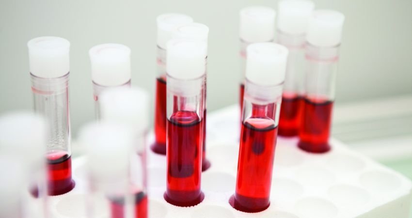 Conhecidas novas informa&ccedil;&otilde;es sobre a realiza&ccedil;&atilde;o de testes r&aacute;pidos de infe&ccedil;&otilde;es por VIH e Hepatites B e C nas farm&aacute;cias e laborat&oacute;rios