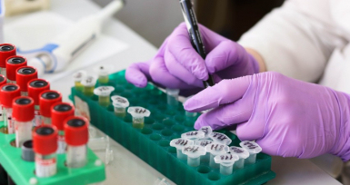 Upadacitinib recebe parecer positivo do CHMP para o tratamento da colite ulcerosa em adultos