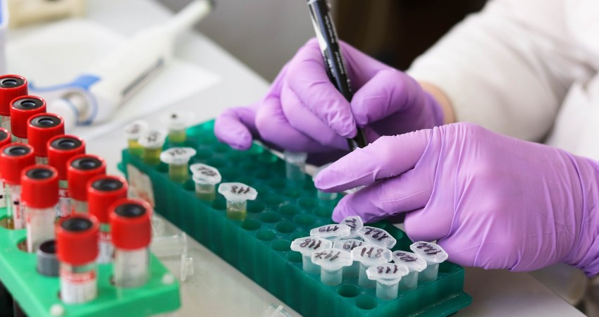 Upadacitinib recebe parecer positivo do CHMP para o tratamento da colite ulcerosa em adultos
