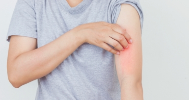 Psor&iacute;ase, dermatite at&oacute;pica e outros eczemas: Farm&aacute;cias registaram aumento exponencial de agudiza&ccedil;&otilde;es e de novos casos em contexto pand&eacute;mico