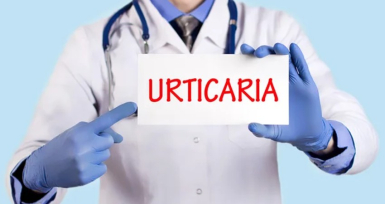 Farm&aacute;cias promovem campanha nacional de rastreios &agrave; urtic&aacute;ria cr&oacute;nica espont&acirc;nea