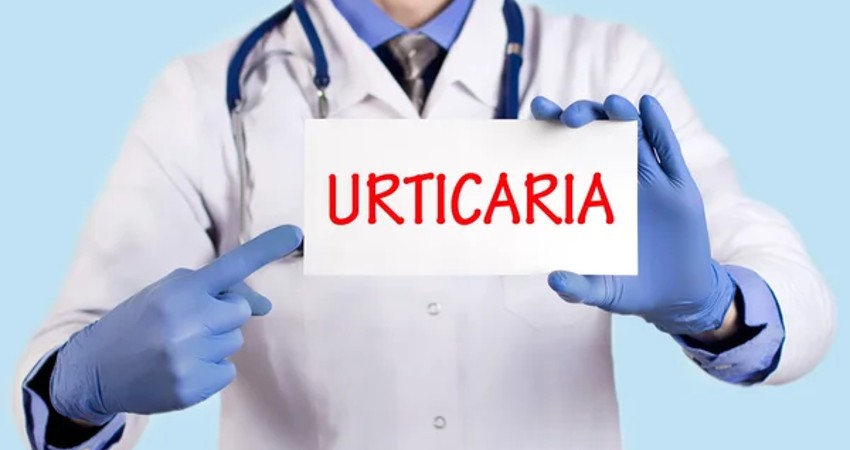 Farm&aacute;cias promovem campanha nacional de rastreios &agrave; urtic&aacute;ria cr&oacute;nica espont&acirc;nea